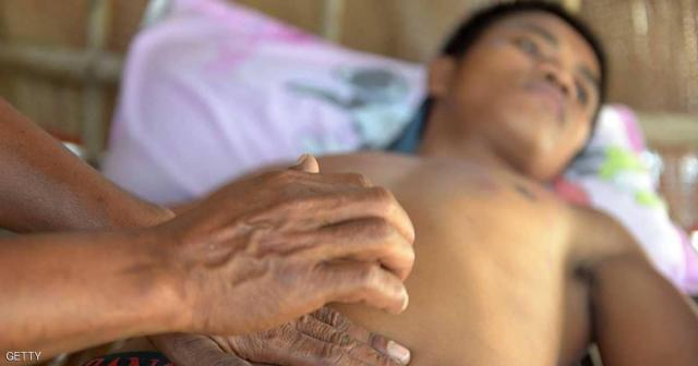 عبارة نسمعها ولا نفهم معناها.. ما حقيقة البرد في المعدة ؟