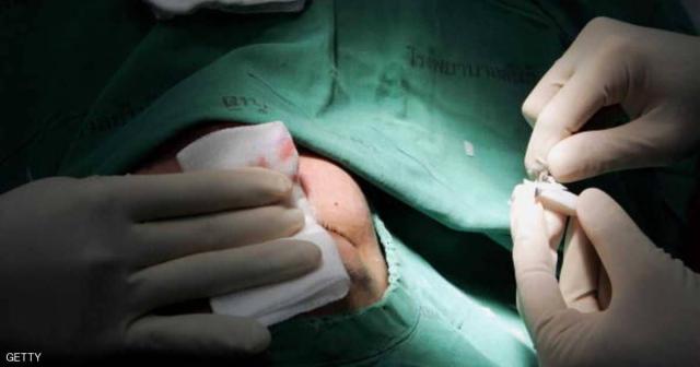 عمليات تجميل الأنف.. معلومات ومخاطر