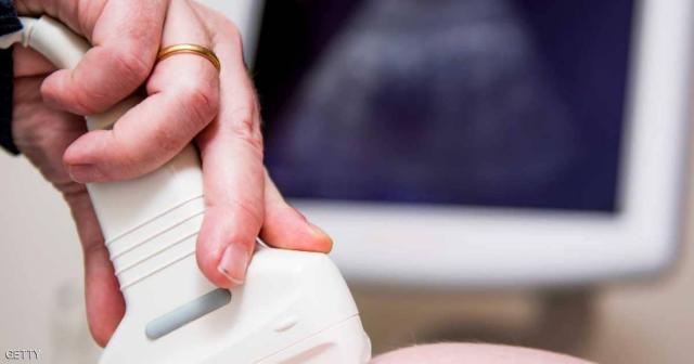 مفاجأة تذهل العلماء.. اكتشاف نوع نادر من التوائم البشرية