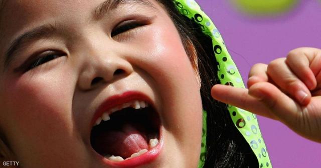 دراسة تكشف حقيقة الرابط بين الجينات وتسوس أسنان الأطفال