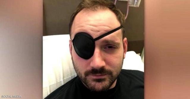 طقطقة رقبة تنتهي بكارثة.. ورسالة تحذير للجميع