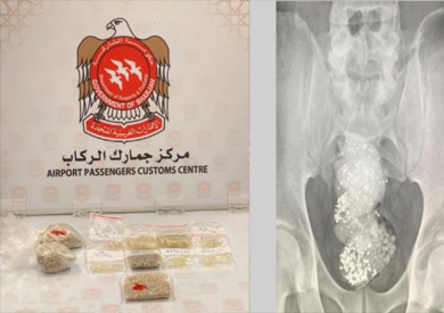 ضبط مسافر يخفي 297 جرام ألماس داخل أحشائه في الإمارات