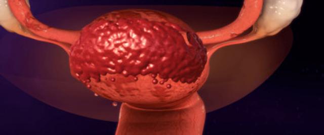 توقيع مذكرة تفاهم بين «برنامج مكافحة الإيدز» و«وكالة الطاقة الذرية» لمواجهة سرطان عنق الرحم