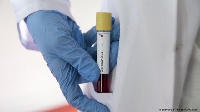 علماء روس يطورون علاجا لفيروس كورونا من دماء الناجين خلال 30 يوما