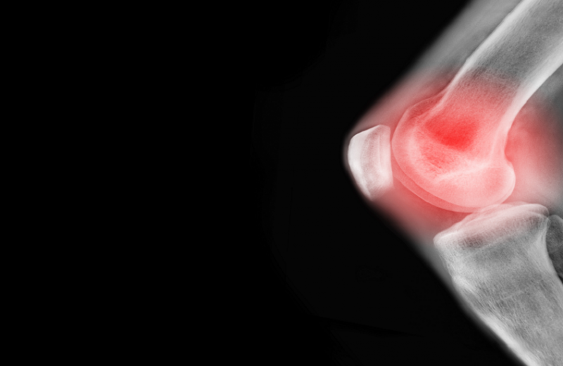 دراسة تؤكد فوائد تمارين اليوغا لعلاج آلام مفاصل الركبة